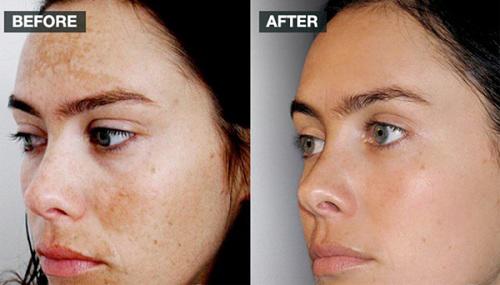 Dùng củ cải và giá đỗ rồi làm theo công thức này, nám nặng đến đâu cũng bị đánh bay - 6