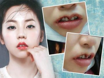 Khi bạn muốn đôi môi trái tim, còn bác sĩ lại muốn khắc nguyên hình trái tim lên mặt bạn...