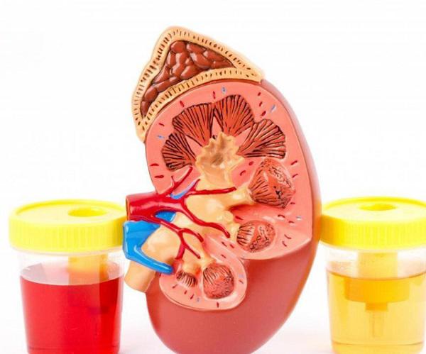 Người phụ nữ cầu cứu bác sĩ vì đi vệ sinh ra máu sau khi làm amp;#34;chuyện ấyamp;#34; với chồng - 1