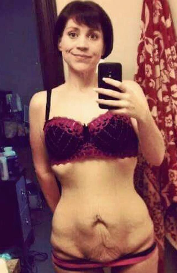 Vợ từ chối gần gũi chồng vì bụng phệ che cả amp;#34;vùng kínamp;#34; sau khi sinh con - 1