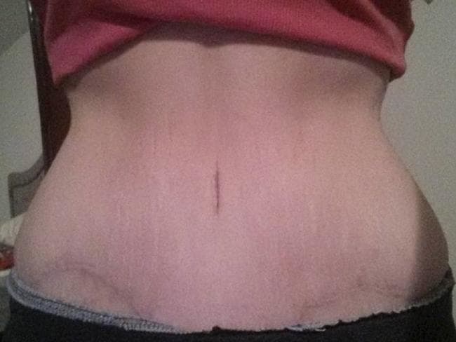 Vợ từ chối gần gũi chồng vì bụng phệ che cả amp;#34;vùng kínamp;#34; sau khi sinh con - 4