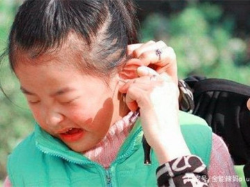 Bà cho dầu ăn vào tai đau của cháu gái, đến viện bác sĩ khen "Bà cứu cháu bà đấy"