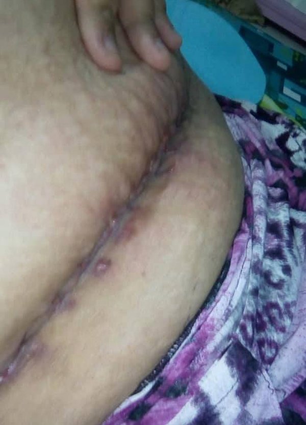 bong thay “co cai gi dap lup bup” trong bung, 9x sai gon di kham phat hien bau 6 thang - 5