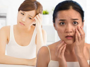 Làm đẹp - Những thông tin đáng chú ý của bác sĩ da liễu về những vấn đề chị em thường gặp phải