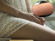 Sức khỏe - Nhập viện sau đêm tân hôn, người vợ ngỡ ngàng phát hiện cả đời khó "chiều" chồng