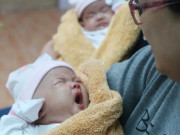 Tin tức - 2 bé sơ sinh dính liền phần gan: "Suốt thai kỳ, tôi giấu gia đình, không cho ai biết"