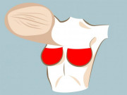 Sức khỏe - Nếu có 6 dấu hiệu này ở ngực, đừng coi nhẹ nên đi khám ngay trước khi muộn