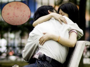 Sức khỏe - Bé trai 11 tuổi bị giang mai, bác sĩ cảnh báo nguy cơ khi quan hệ tình dục sớm
