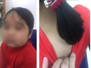 Sức khỏe - Con gái mập ra, mọc nhiều lông mẹ tưởng dậy thì, đi khám BS chỉ nguyên nhân do xịt mũi