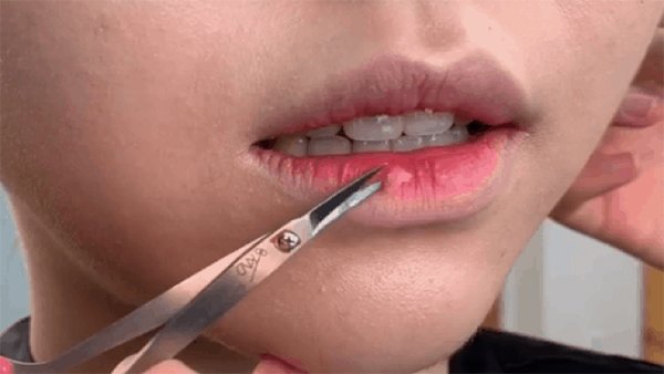 Chị em đừng bắt chước Nam Em làm điều này nếu không muốn rước họa vào thân - 2