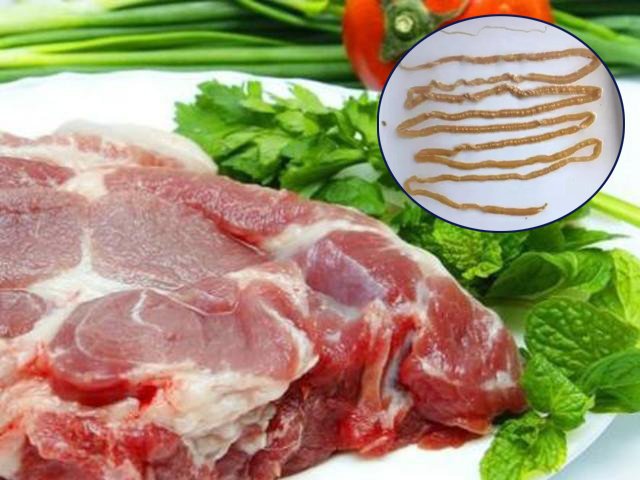Người đàn ông thải ra sán dây 2,9 mét, loại thực phẩm này nhất định phải lưu ý