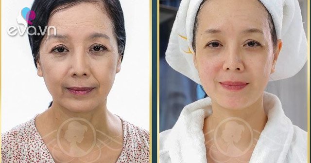 Làm chậm quá trình lão hóa da: Tưởng không dễ mà dễ không tưởng