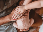 Bà bầu - Em bé chào đời với vết sẹo chằng chịt trên lưng, nguyên nhân do "chào đời" hai lần