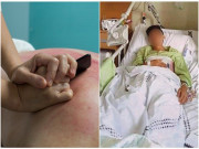 Sức khỏe - Sau khi đi massage thư giãn, người đàn ông 36 tuổi vội vã nhập viện vì đột quỵ