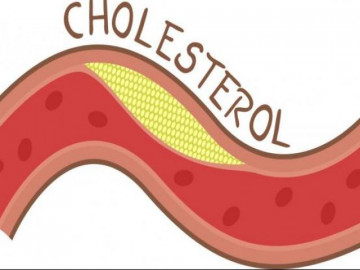 Những điều cần biết về cholesterol