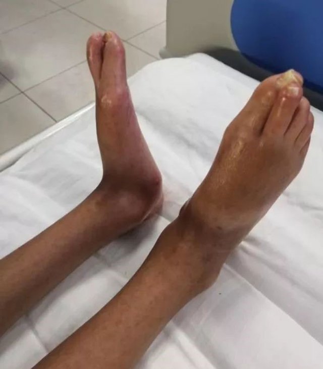 Nhịn ăn nuôi em trai bệnh tật, cô gái 24 tuổi chỉ nặng 21kg chia sẻ mơ ước nhói lòng - 6