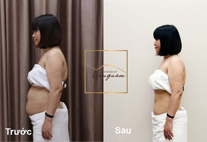 Chồng bỏ chồng chê vì không tự yêu lấy mình - 1
