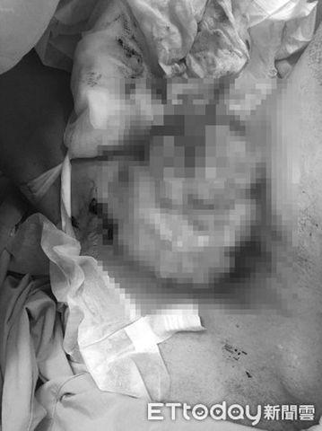 amp;#34;Cậu nhỏamp;#34; quá lớn không kéo nổi khóa quần, người đàn ông đi khám mới sững sờ - 3