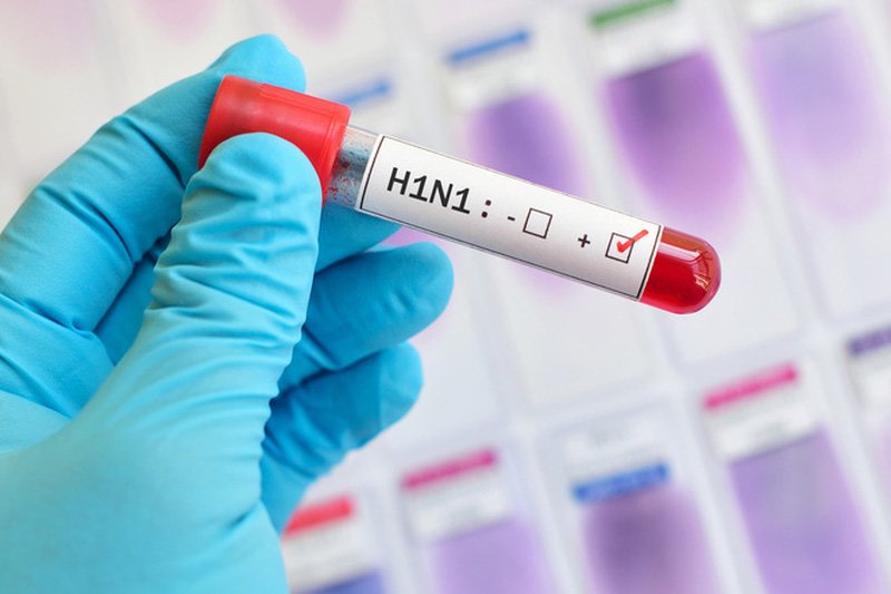 2 trường hợp tử vong do cúm A/H1N1: Bác sĩ khuyên làm điều này nếu không muốn mắc bệnh - 1