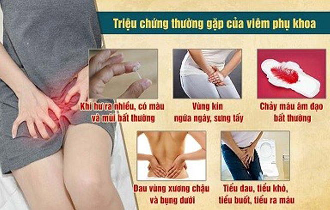 Khí hư nhiều, ngứa vùng kín - dấu hiệu ung thư cổ tử cung chị em thường bỏ qua    - 2