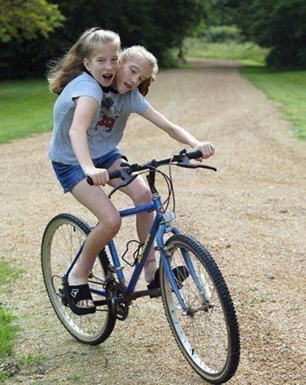 Cuộc sống sau 29 năm của cặp chị em sinh đôi dính liền thân nổi tiếng thế giới - 5