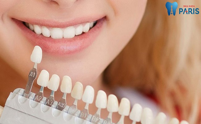 5 quan niệm sai lầm hài hước về bọc răng sứ mà nhiều người mắc phải - 2