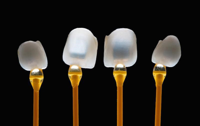 5 quan niệm sai lầm về bọc răng sứ nhiều người mắc phải - 4