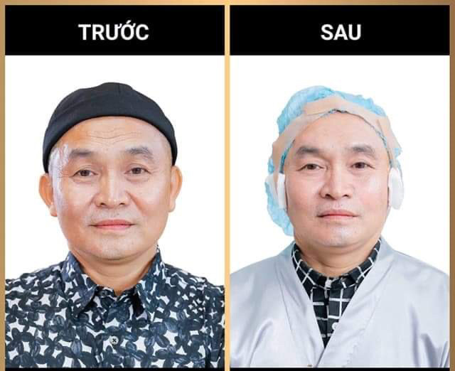 Danh hài Xuân Hinh: “60 năm cuộc đời, tôi vẫn muốn làm kẻ chọc cười dân dã” - 3