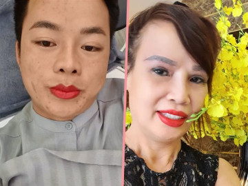 Hết nhấn mí, cô dâu 62 tuổi lại dẫn chồng đi xăm môi khiến CĐM bất ngờ