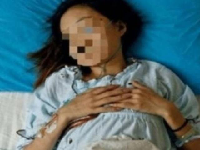 Cô gái 26 tuổi ung thư dạ dày do thường ăn đồ rẻ tiền để tiết kiệm mua mỹ phẩm