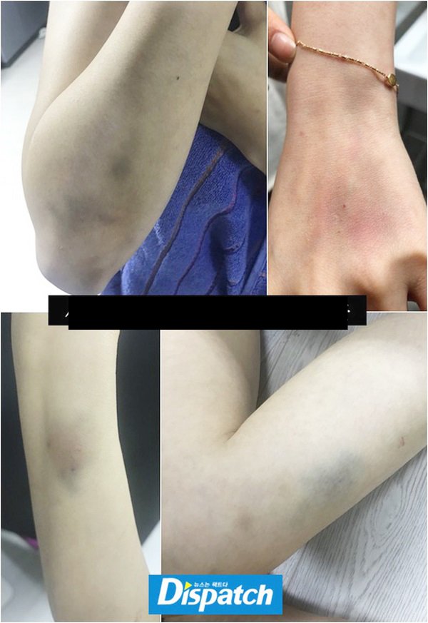 Goo Hara qua đời, hành động đầu tiên của bạn trai cũ Choi Jong Bum mới đáng bàn - 5