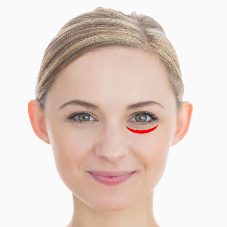 Nếu bạn trẻ mà đã có nếp nhăn ở những khu vực này, cẩn thận loạt bệnh đang kéo đến - 6