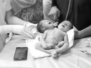 Tin tức - Tưởng sinh đôi 2 con trai, người mẹ ngất xỉu khi nhìn thấy đứa trẻ bác sĩ bế ra