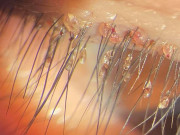 Làm đẹp - Còn ai muốn nối mi giả khi nhìn thấy ổ chấy rận ký sinh trên nơi "đáng sống" này?