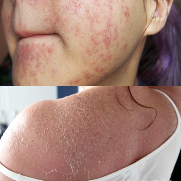 Không riêng kem trộn, giờ chị em còn phải cảnh giác cao độ trước vô vàn loại mỹ phẩm trộn - 2