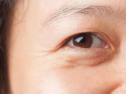 Sức khỏe - Nếu bạn trẻ mà đã có nếp nhăn ở những khu vực này, cẩn thận loạt bệnh đang kéo đến