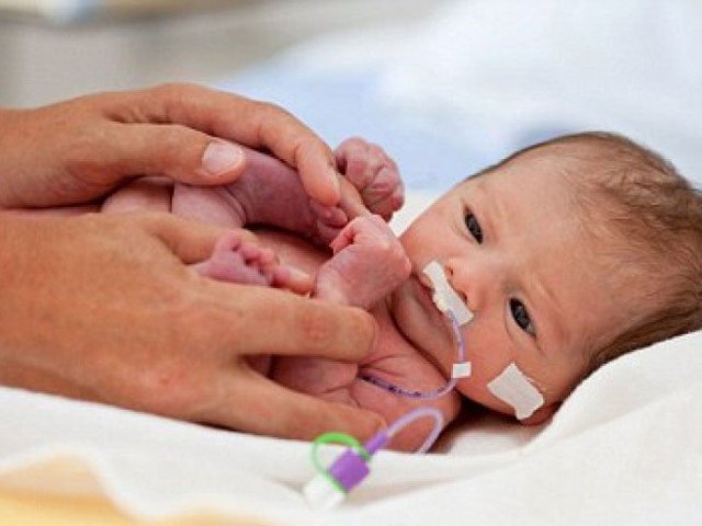 Bác sĩ viện sản: Đây chính là 3 kiểu bà mẹ dễ sinh con dị dạng nhất - 2