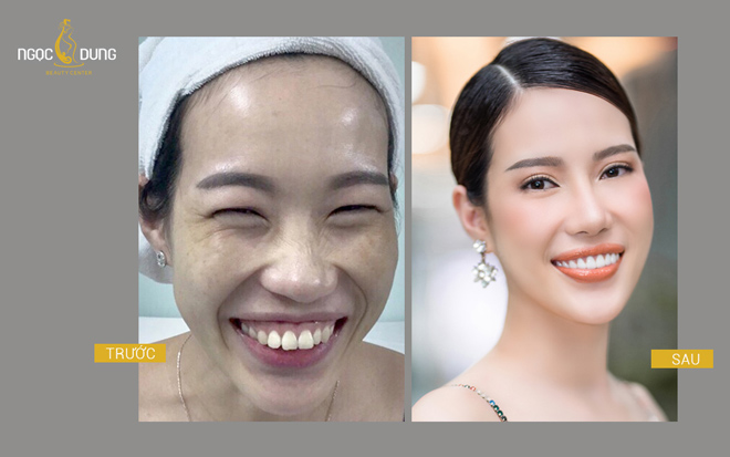 Việt Trinh đầu tư đến Thẩm mỹ viện làm đẹp, đây là gói dịch vụ phái đẹp nên cập nhật - 3