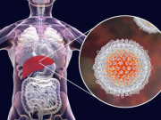 Sức khỏe - 4 dấu hiệu khi đi vệ sinh cảnh báo gan gặp nguy hiểm, chỉ 1 điều cũng cần khám gấp