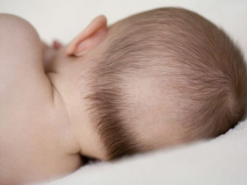 Trẻ bị rụng tóc vành khăn: Nguyên nhân và cách khắc phục hiệu quả nhất