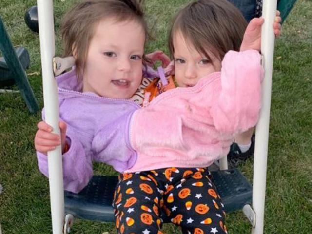 Nhất quyết không bỏ thai dù biết song sinh dính liền, người mẹ nhận kết quả đáng kinh ngạc