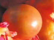 Lifestyle - Mổ con vịt đực nuôi 5 năm, "ẵm" bảo bối trong bụng ngang cả gia tài