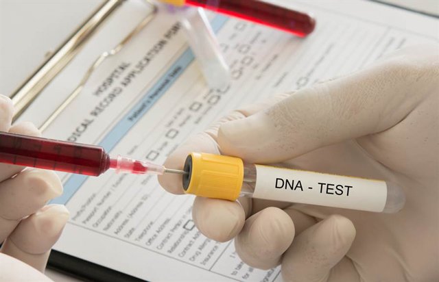 3 tháng sau khi phẫu thuật ghép tủy, người đàn ông sốc nặng khi đi xét nghiệm ADN - 2