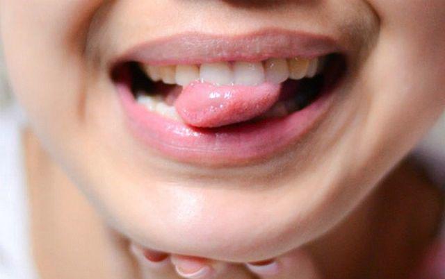 Thức dậy thấy 4 biểu hiện bất thường này cẩn thận mắc căn bệnh chết nhanh hơn ung thư - 3