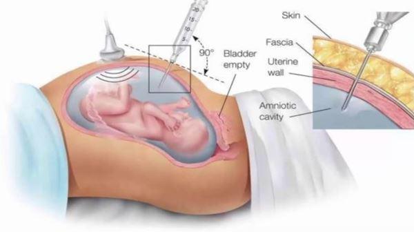 Các xét nghiệm sàng lọc trước sinh và tuần thực hiện - 6