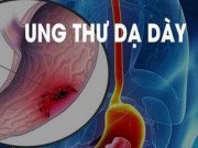 Sức khỏe - Không ngờ loại gia vị người Việt nào cũng từng dùng lại gây ung thư dạ dày