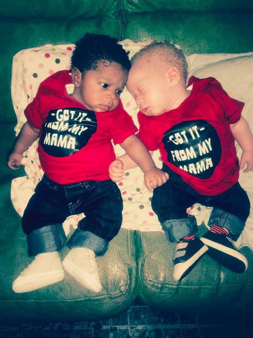 Bố mẹ đều da đen tóc xoăn, đi đẻ bác sĩ tròn mắt vì lấy ra em bé trắng bóc - 3