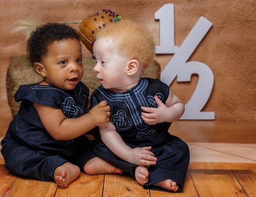 Bố mẹ đều da đen tóc xoăn, đi đẻ bác sĩ tròn mắt vì lấy ra em bé trắng bóc - 4