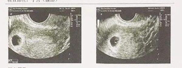 Ngôi sao 24/7: Cho con gái đi du học, amp;#34;ông bố quốc dânamp;#34; ở nhà thay bồ như thay áo? - 7