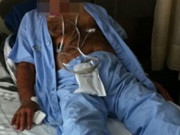 Sức khỏe - Những người khổ vì "cậu nhỏ chào cờ": Người 10 năm không xuống, kẻ chịu 8 tháng vì chiều vợ